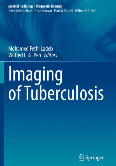 Book cover of: Imaging of Tuberculosis. By: Mohamed Fethi Ladeb