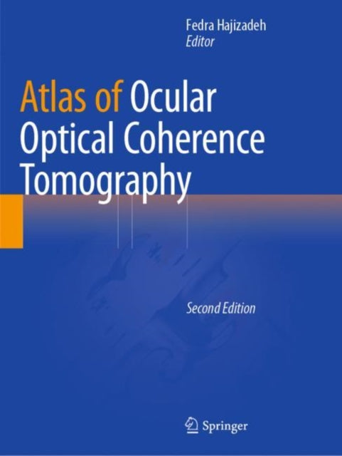 Book cover of: Atlas of Ocular Optical Coherence Tomography. By: Fedra Hajizadeh
