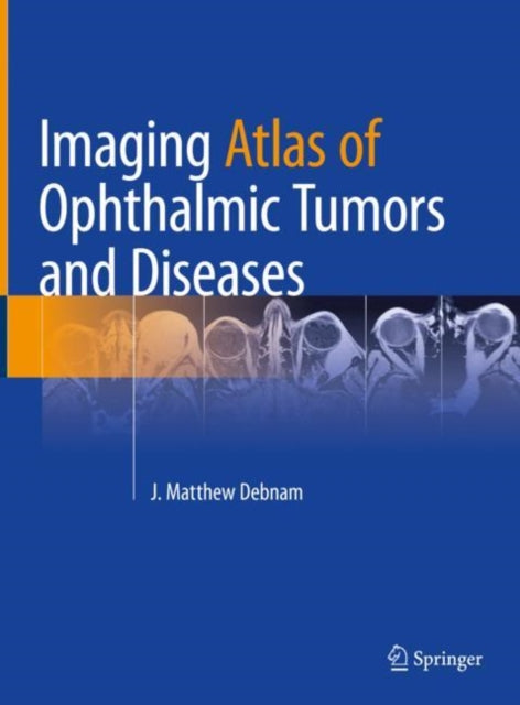 Book cover of: Imaging Atlas of Ophthalmic Tumors and Diseases. By: J. Matthew Debnam
