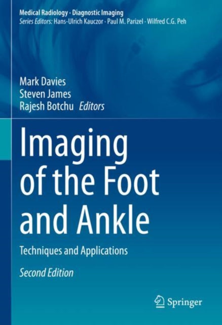 Book cover of: Imaging of the Foot and Ankle. By: Mark Davies