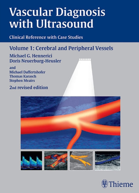 Book cover of: Vascular Diagnosis with Ultrasound