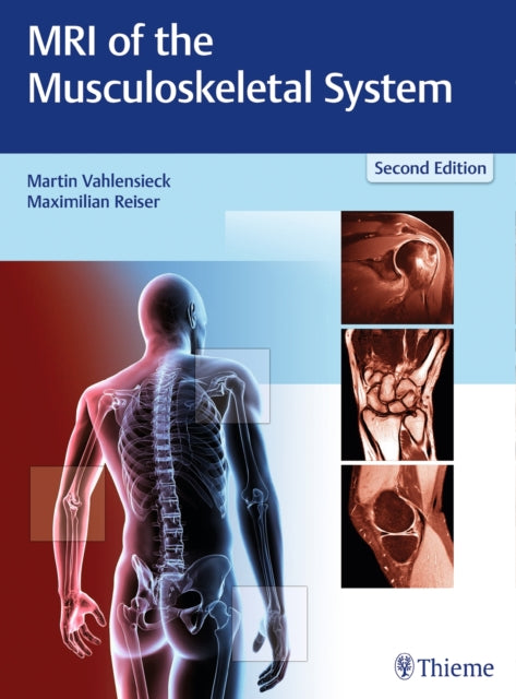 Book cover of: MRI of the Musculoskeletal System. By: Martin Vahlensieck