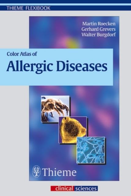 Book cover of: Color Atlas of Allergic Diseases