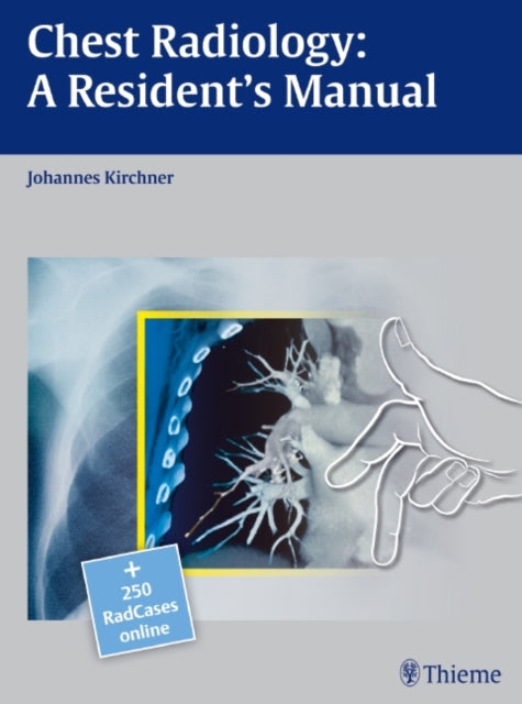 Book cover of: Chest Radiology: a Resident's Manual. By: Johannes Kirchner