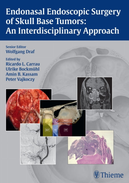 Book cover of: Endonasal Endoscopic Surgery of Skull Base Tumors: an Interdisciplinary Approach. By: Wolfgang Draf