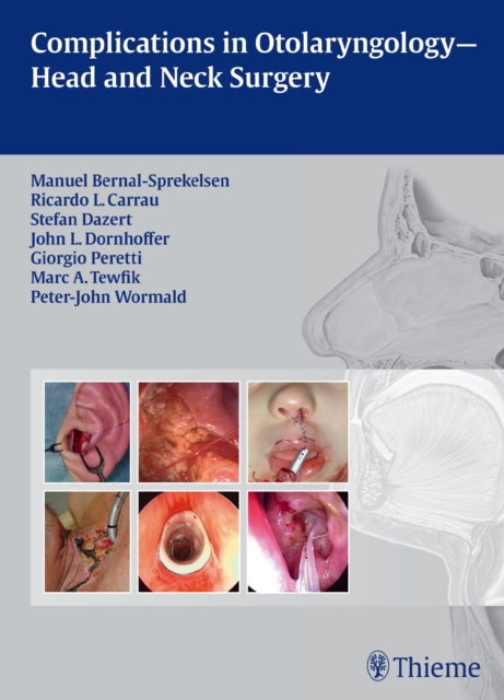 Book cover of: Complications in Otolaryngology - Head and Neck Surgery. By: Manuel Bernal-Sprekelsen