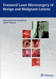 Book cover of: Transoral Laser Microsurgery of Benign and Malignant Lesions. By: Manuel Bernal-Sprekelsen
