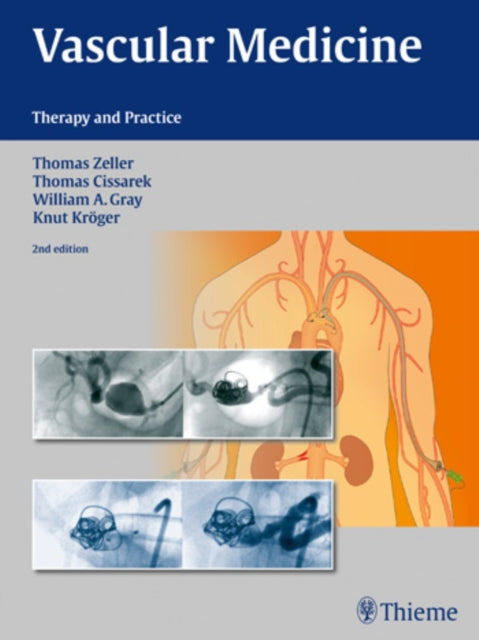 Book cover of: Vascular Medicine. By: Zeller, Thomas (Professor of angiology)