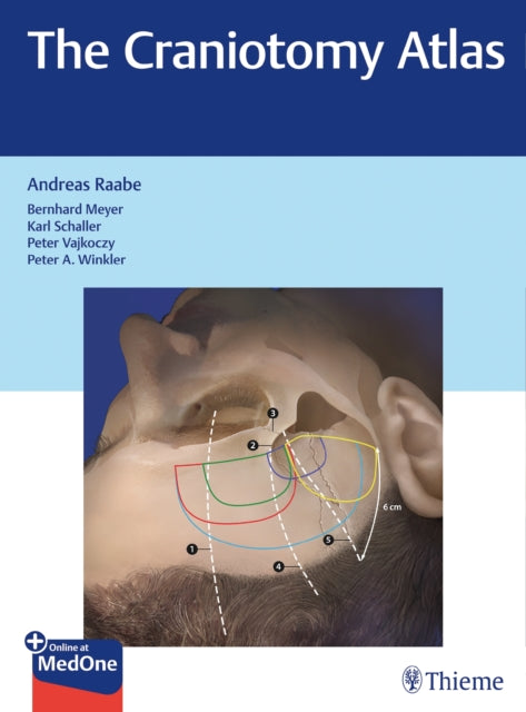Book cover of: Craniotomy Atlas. By: Andreas Raabe
