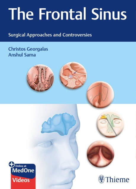 Book cover of: Frontal Sinus. By: Christos Georgalas