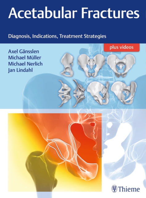Book cover of: Acetabular Fractures. By: Axel Gänsslen