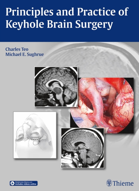 Book cover of: Principles and Practice of Keyhole Brain Surgery. By: Charles Teo