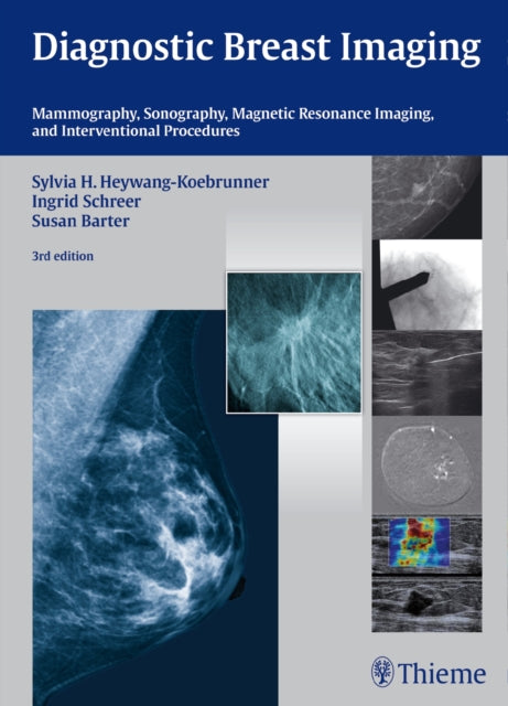 Book cover of: Diagnostic Breast Imaging. By: Sylvia H. Heywang-Köbrunner