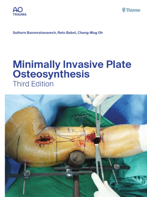 Book cover of: Minimally Invasive Plate Osteosynthesis. By: Suthorn Bavonratanavech