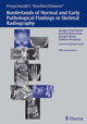 Book cover of: Freyschmidt's "Koehler/Zimmer" Borderlands of Normal and Early Pathological Findings in Skeletal Radiography. By: Jurgen Freyschmidt