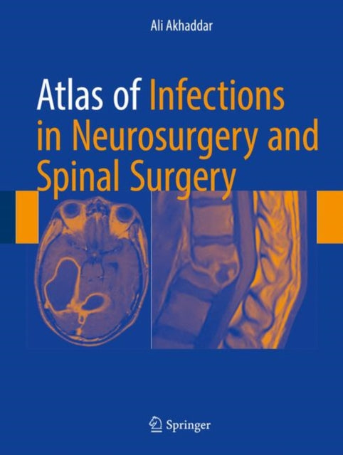 Book cover of: Atlas of Infections in Neurosurgery and Spinal Surgery. By: Ali Akhaddar