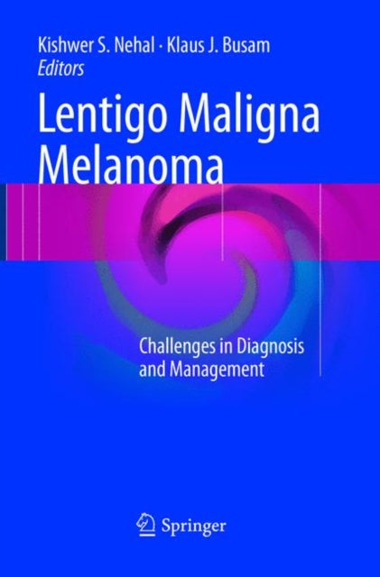 Book cover of: Lentigo Maligna Melanoma. By: Kishwer S. Nehal