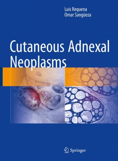 Book cover of: Cutaneous Adnexal Neoplasms. By: Luis Requena