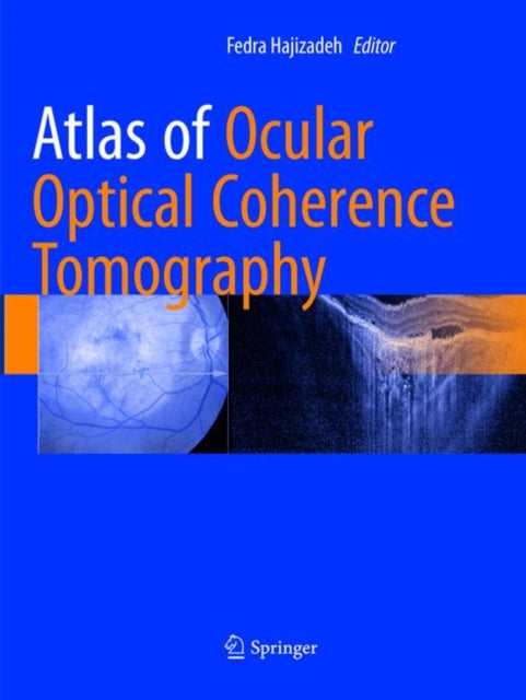 Book cover of: Atlas of Ocular Optical Coherence Tomography. By: Fedra Hajizadeh