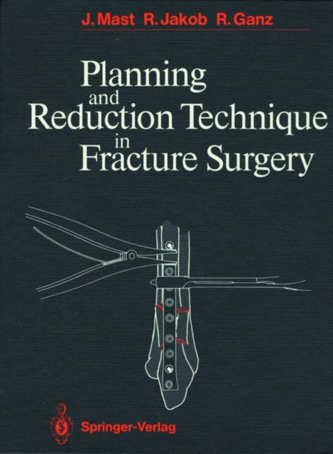 Book cover of: Planning and Reduction Technique in Fracture Surgery. By: Jeffrey Mast