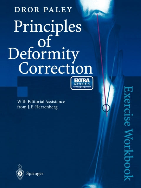 Book cover of: Principles of Deformity Correction. By: Dror Paley
