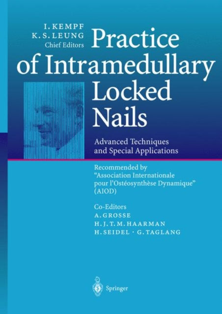 Book cover of: Practice of Intramedullary Locked Nails