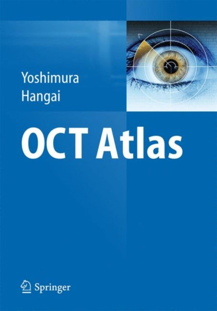 Book cover of: OCT Atlas. By: Nagahisa Yoshimura