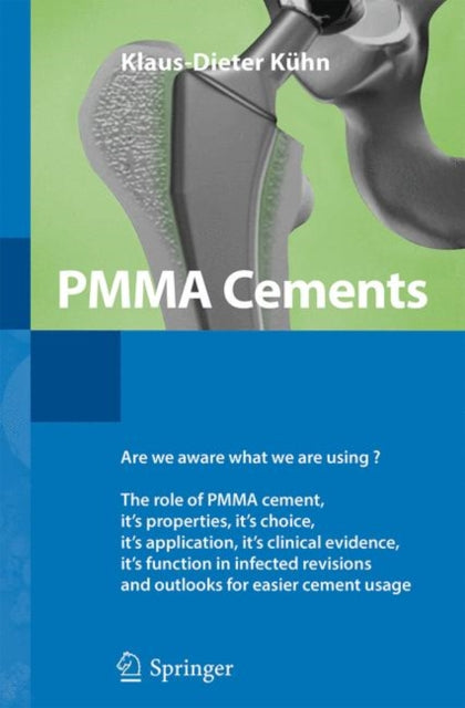 Book cover of: PMMA Cements. By: Klaus-Dieter Kühn
