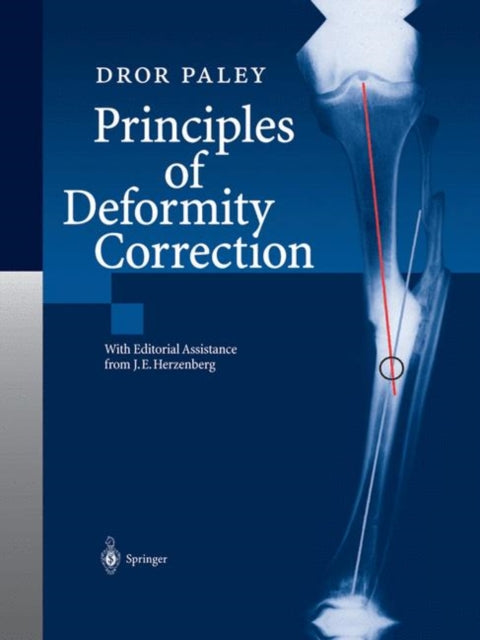 Book cover of: Principles of Deformity Correction. By: J. E. Herzenberg