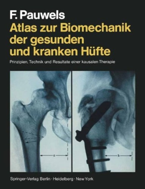 Book cover of: Atlas zur Biomechanik der gesunden und kranken Hufte. By: F. Pauwels