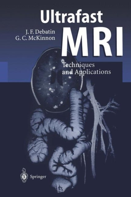 Book cover of: Ultrafast MRI. By: Jörg F. Debatin