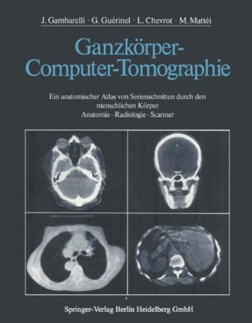 Book cover of: Ganzkorper-Computer-Tomographie. By: J. Gambarelli