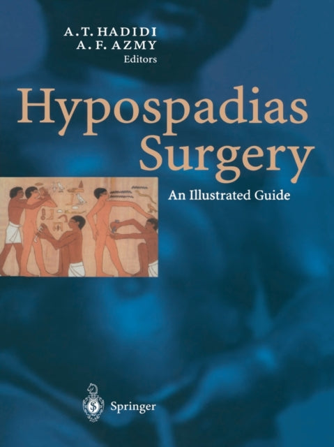Book cover of: Hypospadias Surgery. By: Ahmed Hadidi