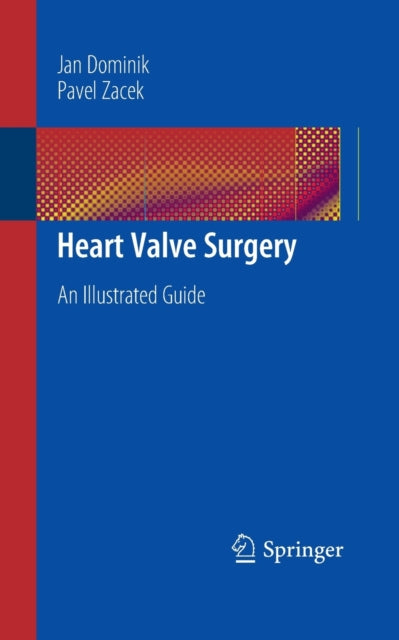 Book cover of: Heart Valve Surgery. By: Jan Dominik