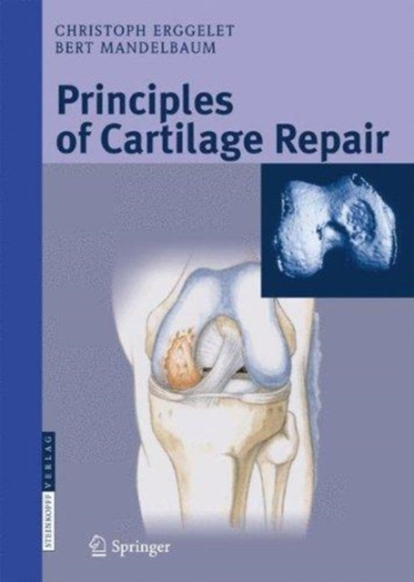 Book cover of: Principles of Cartilage Repair. By: Christoph Erggelet