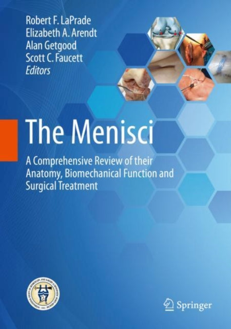 Book cover of: Menisci. By: Robert F. LaPrade