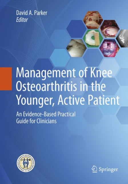 Book cover of: Management of Knee Osteoarthritis in the Younger, Active Patient. By: David Parker