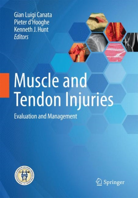 Book cover of: Muscle and Tendon Injuries. By: Gian Luigi Canata