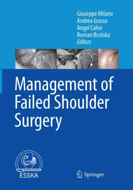 Book cover of: Management of Failed Shoulder Surgery