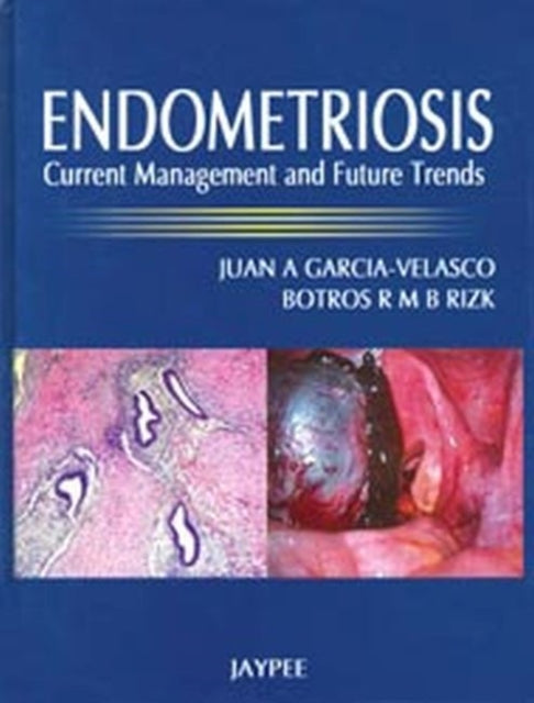 Book cover of: Endometriosis. By: Juan A. Garcia-Velasco