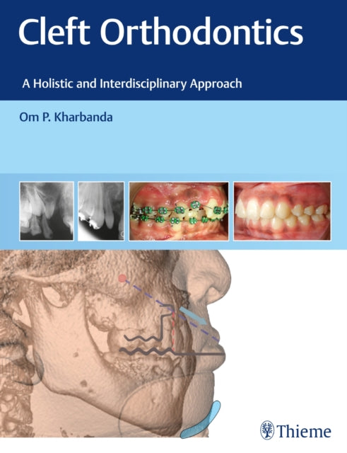 Book cover of: Cleft Orthodontics. By: Om P. Kharbanda