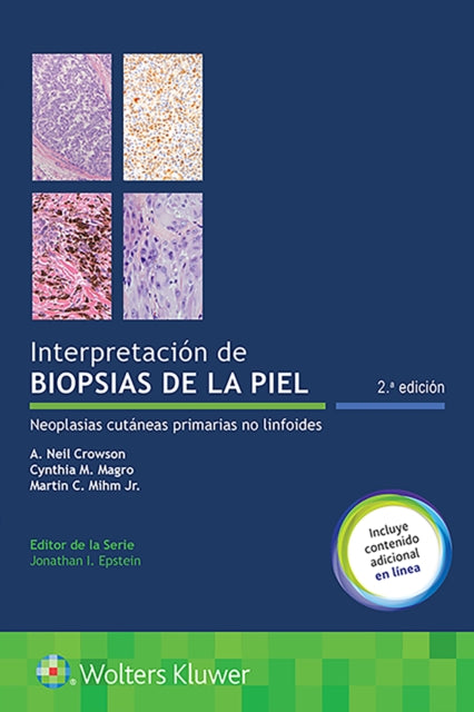 Book cover of: Interpretacion de biopsias de la piel. By: A. Neil Crowson