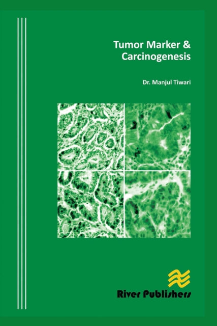 Book cover of: Tumor Marker and Carcinogenesis