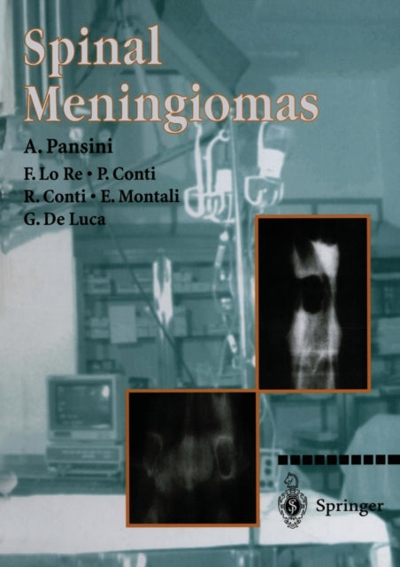 Book cover of: Spinal Meningiomas. By: A. Pansini