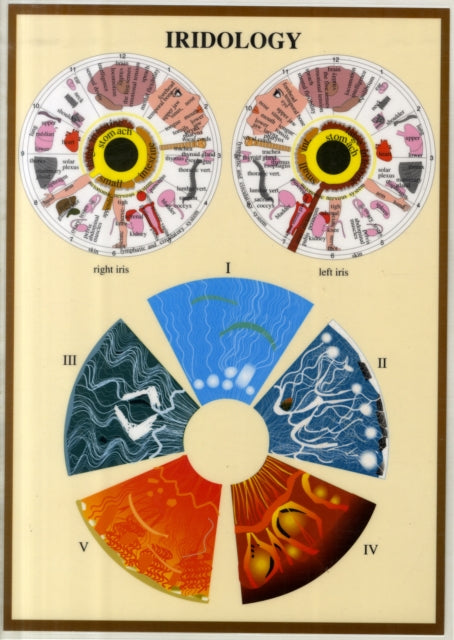 Book cover of: Iridology -- A4