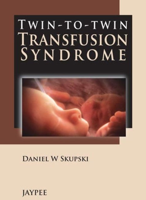 Book cover of: Twin-to-Twin Transfusion Syndrome. By: Daniel W. Skupski