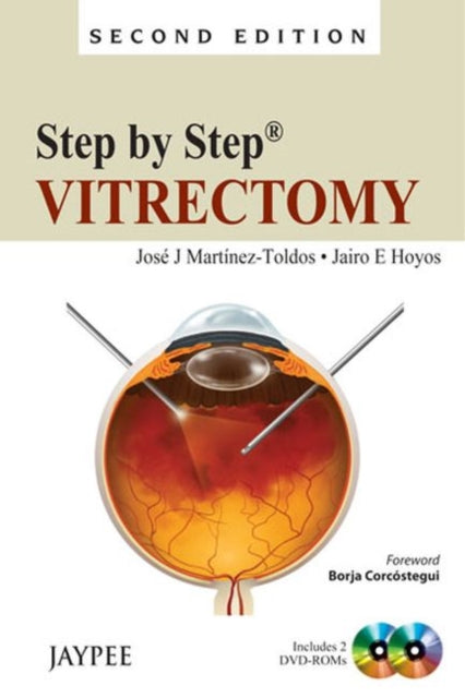 Book cover of: Step by Step: Vitrectomy. By: Jose J. Martinez-Toldos