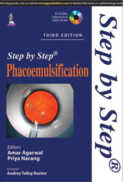 Book cover of: Step by Step Phacoemulsification. By: Amar Agarwal