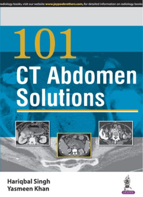 Book cover of: 101 CT Abdomen Solutions. By: Hariqbal Singh