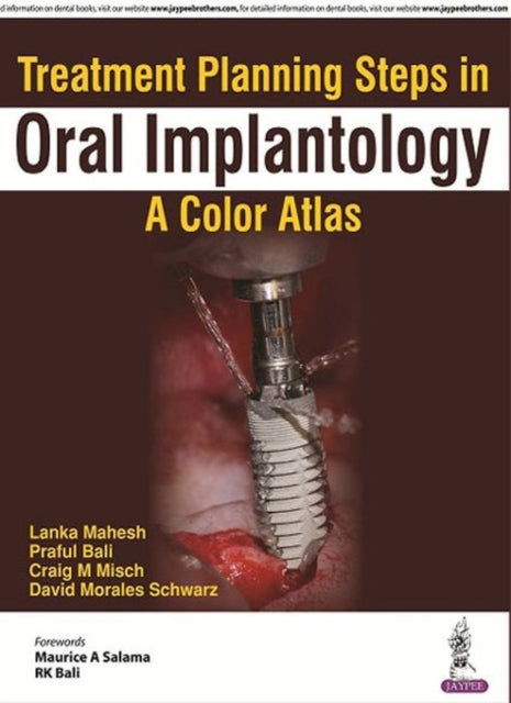 Book cover of: Treatment Planning Steps in Oral Implantology. By: David Morales Schwarz